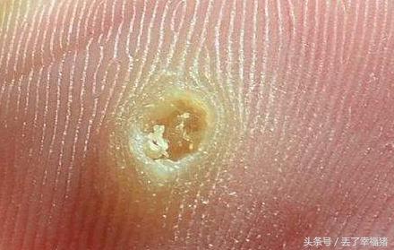 脚部出现这些问题可能是疾病先兆,脚不容忽视的健康信号