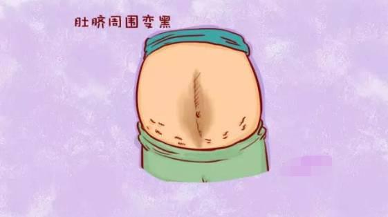 孕期这4种症状是胎宝在保平安,怀孕后身体哪几个部位变黑