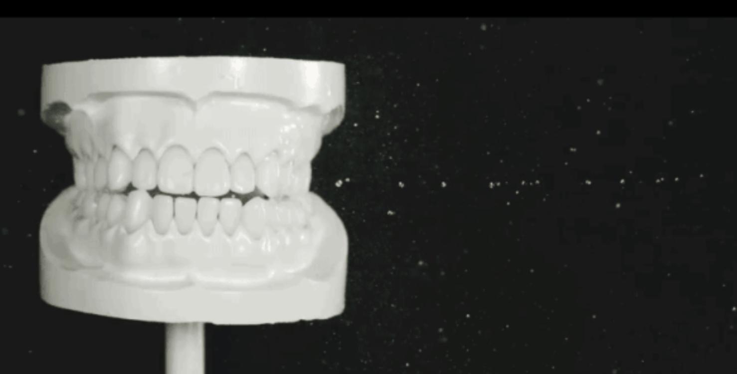 号称能去除菌斑牙的冲牙器,牙菌斑有了用牙刷还是冲牙器