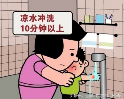 不谨慎烫伤了要涂什么药,不谨慎烫伤要怎么样才可以不烫