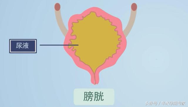 产后尿潴留ppt,产后尿潴留的正确处理措施是什么