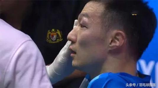 羽毛球打在眼睛上怎么处理,眼睛被羽毛球打后睁不开眼睛