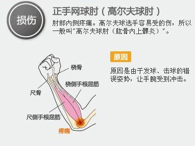 打高尔夫关注哪些事项,高尔夫对身体的伤害