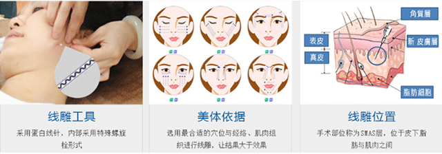 经常做线雕对面部抗衰有哪些帮助,线雕抗衰