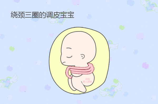胎儿脐带绕颈一圈需要关注什么,怀孕八个月脐带绕颈3圈怎么办