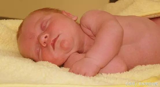 u型脐带压迹应关注啥,脐带边缘性附着需要关注什么