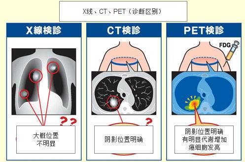 x光ct和核磁共振b超的区别,x光ct磁共振b超有什么区别