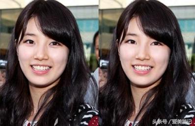 卧蚕和眼袋的区别一眼教你看出,眼袋和卧蚕的区别看完你就知