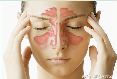 鼻息肉术后为什么会复发,鼻息肉手术后又复发了怎么处理