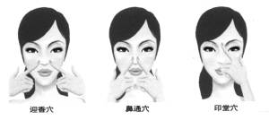鼻炎流鼻涕中医辨证,经常流鼻涕解决小妙招