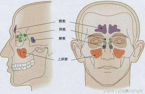 鼻息肉术后为什么会复发,鼻息肉手术后又复发了怎么处理