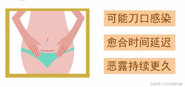 剖宫产的关注事项,剖宫产后洗澡关注事项