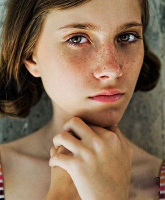 来看看斑点是怎么形成的,16种斑如何分析鉴别