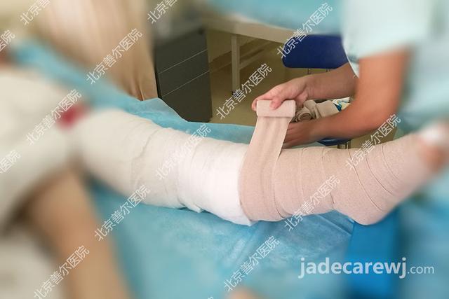 案例分享：乳腺癌术后5年、上肢淋巴水肿的治疗