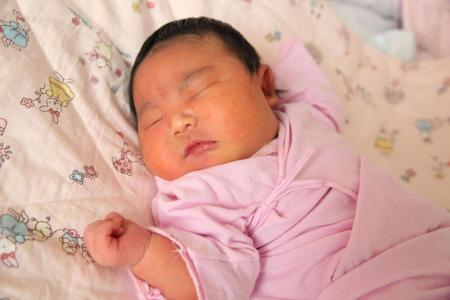 新生儿寒冷损伤症的护理措施,发生新生儿寒冷损伤综合征的原因