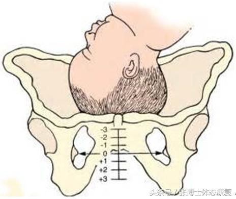 孕期运动操缓解坐骨神经痛,孕期缓解腰背运动操