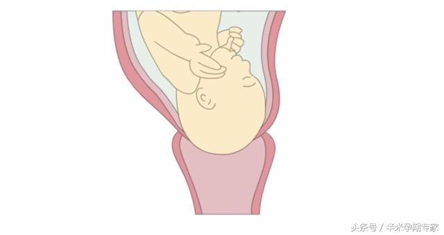 什么是胎儿入盆和开宫口