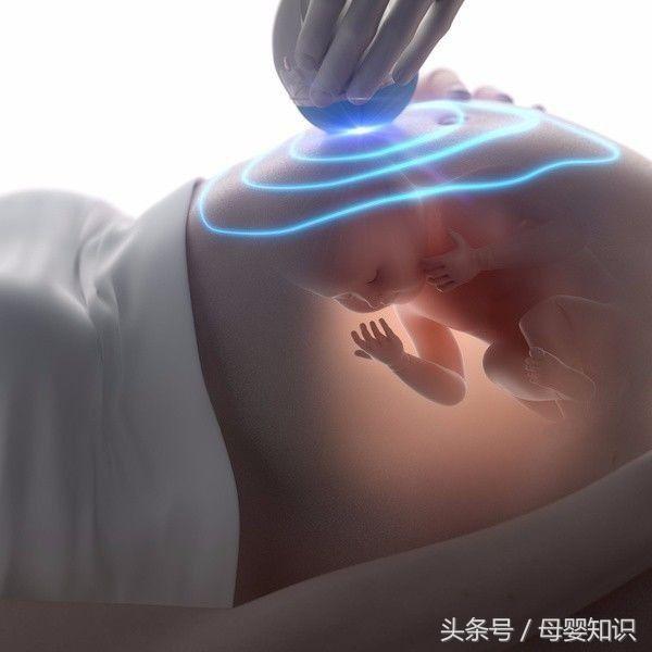 准妈妈应警惕羊水不正常产生的不良影响