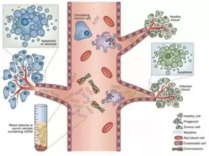 肿瘤活检病理准确率高吗,肿瘤检测石蜡和活检哪个准确率高
