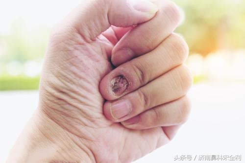 大病先兆自查表全文,大病先兆自查表格