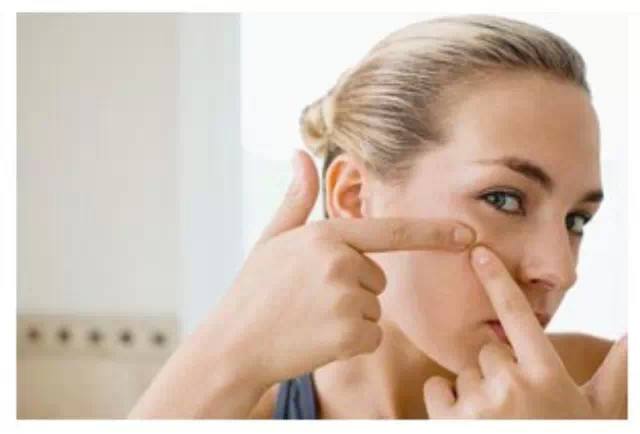 最简单祛痘印真实有效的方法,祛痘印最有效的方法开塞露