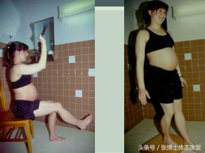 孕期运动操缓解坐骨神经痛,孕期缓解腰背运动操