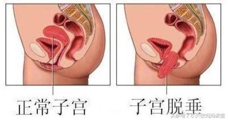 生孩子对女性的身体好不好,生孩子对女性健康好还是不生好