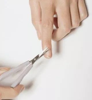 宝宝手起倒刺只需2步快速解决,6个月宝宝手长倒刺怎么办