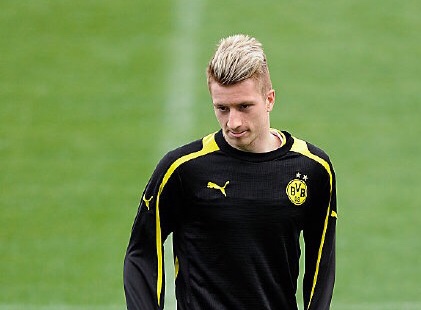 是伤病困扰了他们！如果这十一个玻璃人联手能横扫足坛吗？