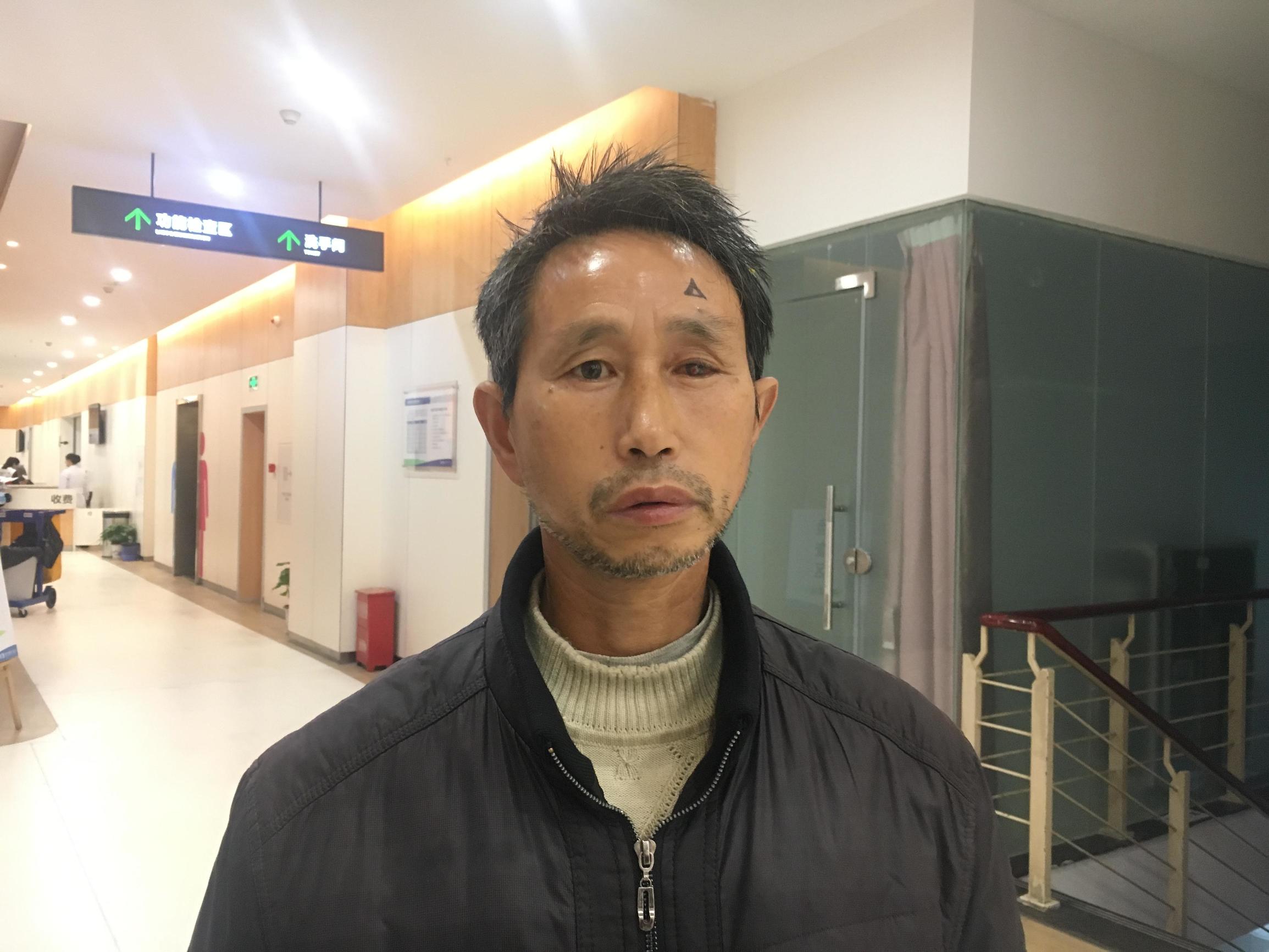 真菌感染角膜移植属于哪种手术,角膜溃疡真菌感染必须角膜移植吗