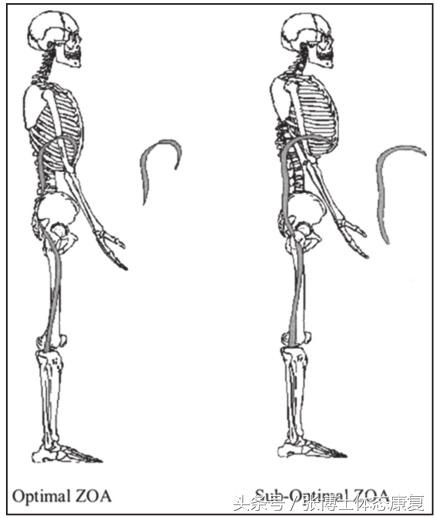 吹气球改善腹内压,吹气球治疗腰痛