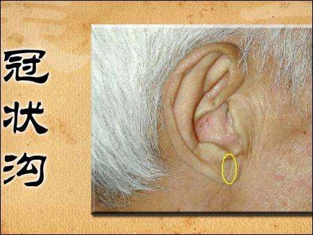 有这几个症状当心心梗正悄悄发生,血汗管堵塞导致的心梗有什么前兆