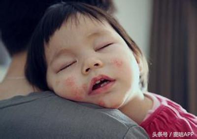 妈妈做对３件事，宝宝用多效修复凝胶湿疹不再来！