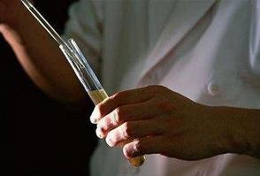 24小时尿蛋白定量留尿关注事项,24小时尿蛋白定量前关注事项