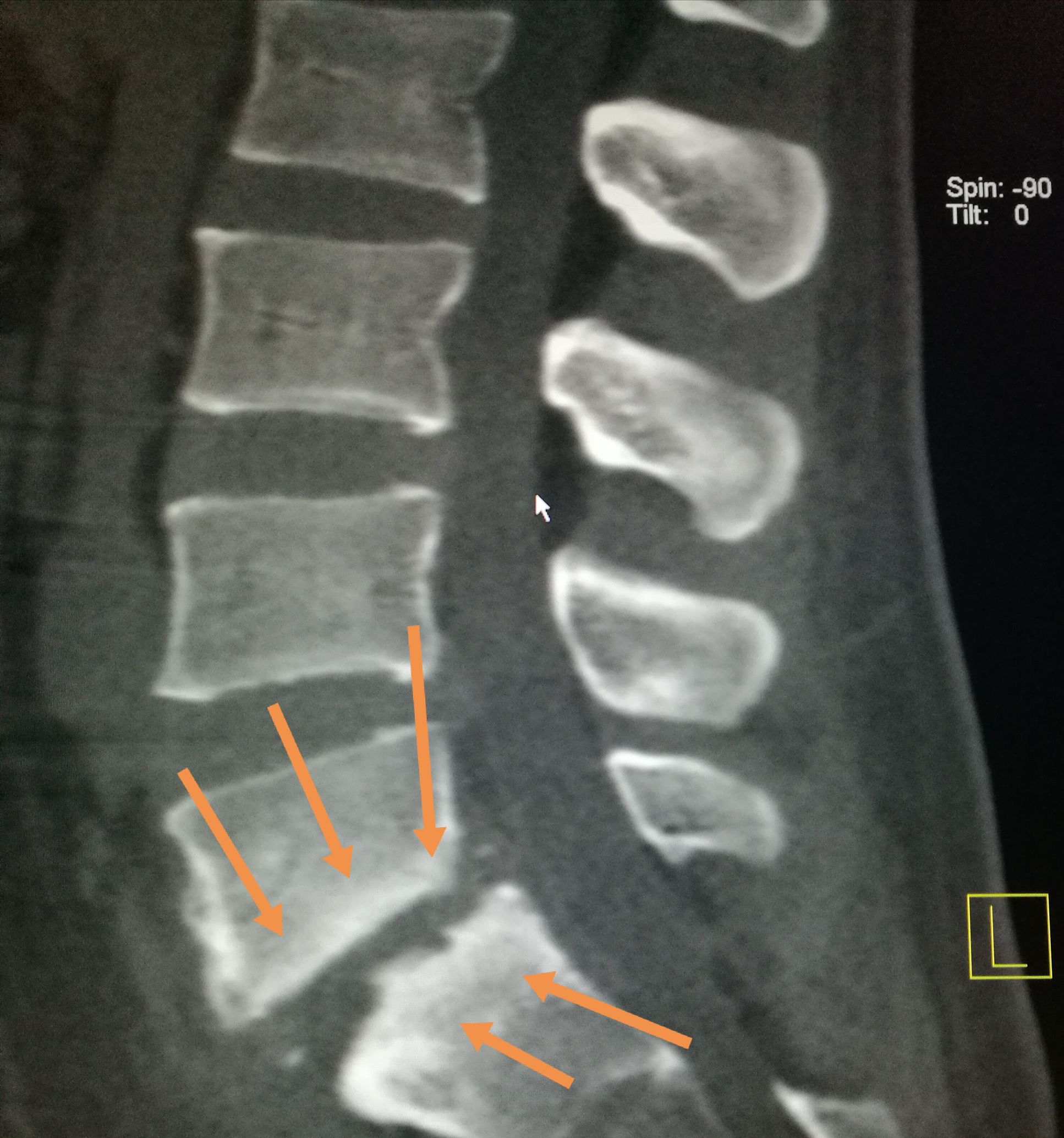 吃羊肉腰胀疼是怎么了,经常吃牛羊肉身体有啥变化