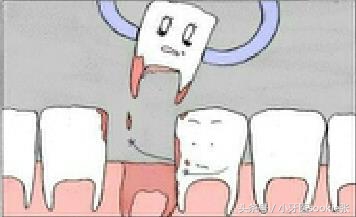 拔牙后吐掉棉球还出血,拔牙后多久才不出血