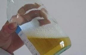 24小时尿蛋白定量留尿关注事项,24小时尿蛋白定量前关注事项