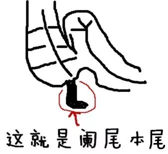 小孩也得急性阑尾炎吗,孩子得急性阑尾炎不痛