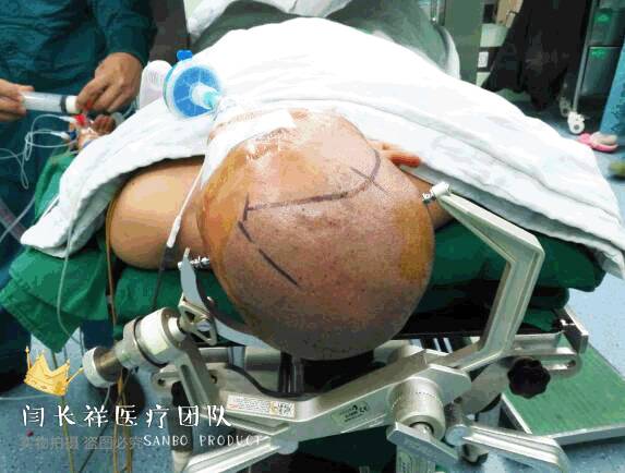 烦人的耳鸣,烦人耳鸣