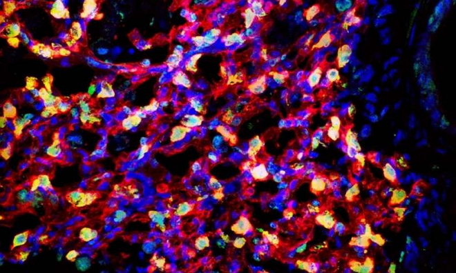 BioWeek一周资讯回顾：华人科学家顾臻又出新成果啦！这次是“癌症免疫疗法贴片”