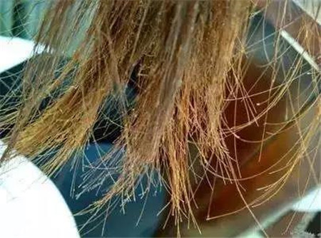 冬天上火怎么办？这些干货教您灭火