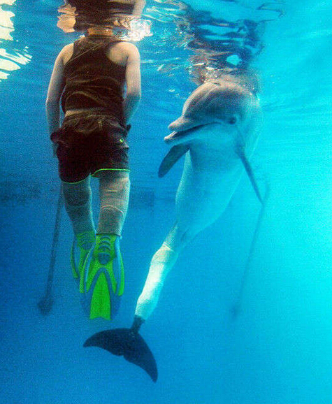 截肢男人励志视频,截肢男孩哭了视频