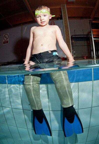 截肢男人励志视频,截肢男孩哭了视频