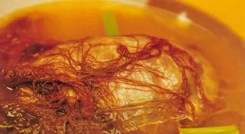 慢性胆囊炎代茶饮,胆结石慢性胆囊炎