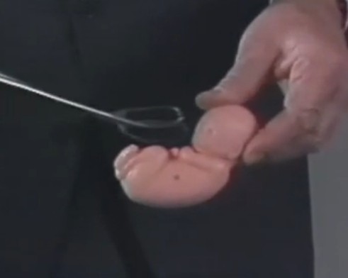 会爱自己才是王道！年轻女生做人流存在六风险