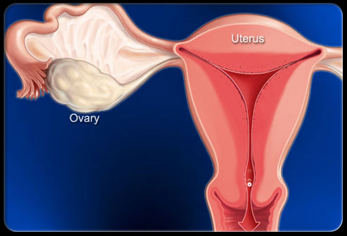 盆腔疼痛怎么引起的,盆腔疼痛是什么原因引起的