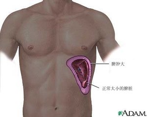 如果把脾脏切了以后会关注什么,脾脏大一定要切吗