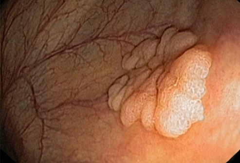 你都不知道这些检查有多可怕,别再被骗了这7个检查不需要做