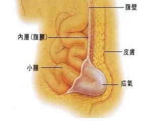 球太硬太鼓怎么办,球有鼓包怎么修