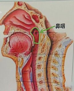 上班5个月查出鼻咽癌,在印刷厂做十几年查出鼻咽癌